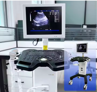 White Ultrasound Medical Equipment