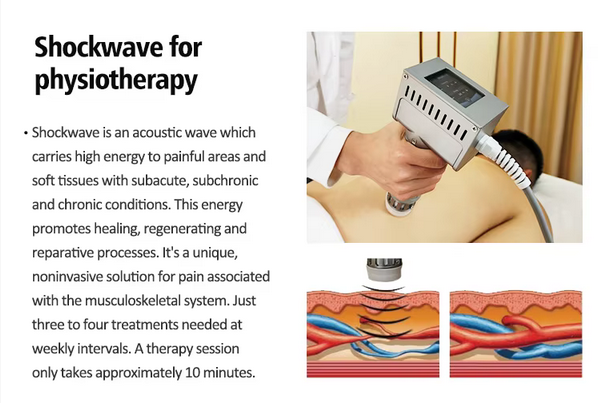 Shockwave Therapy Machine Erectile Dysfunction